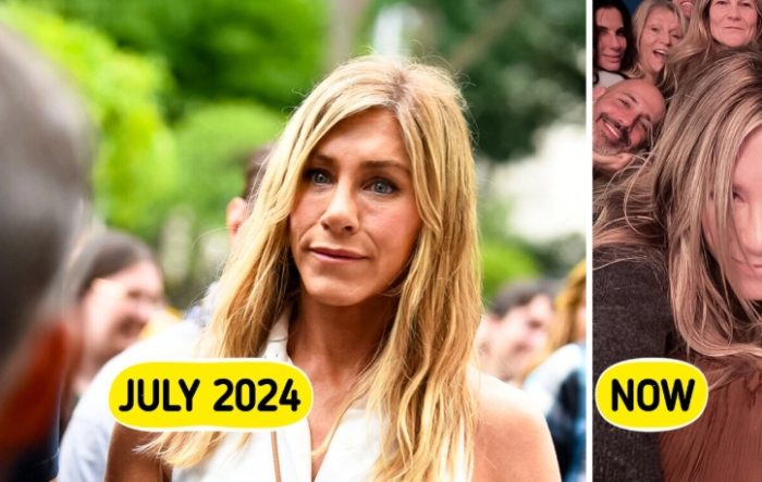 Jennifer Aniston Stuns at 56: See Her Dramatic Change After Removing Fillers